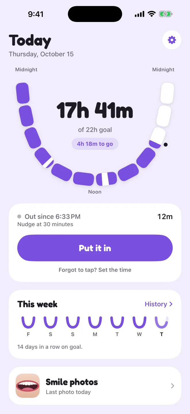 Today screen while the retainer is out, with a reminder time