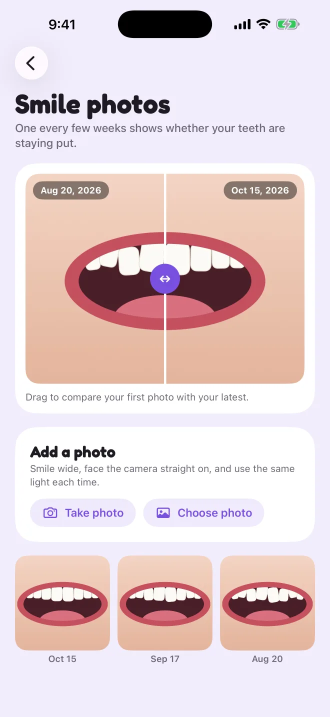 Smile photos with a before and after slider